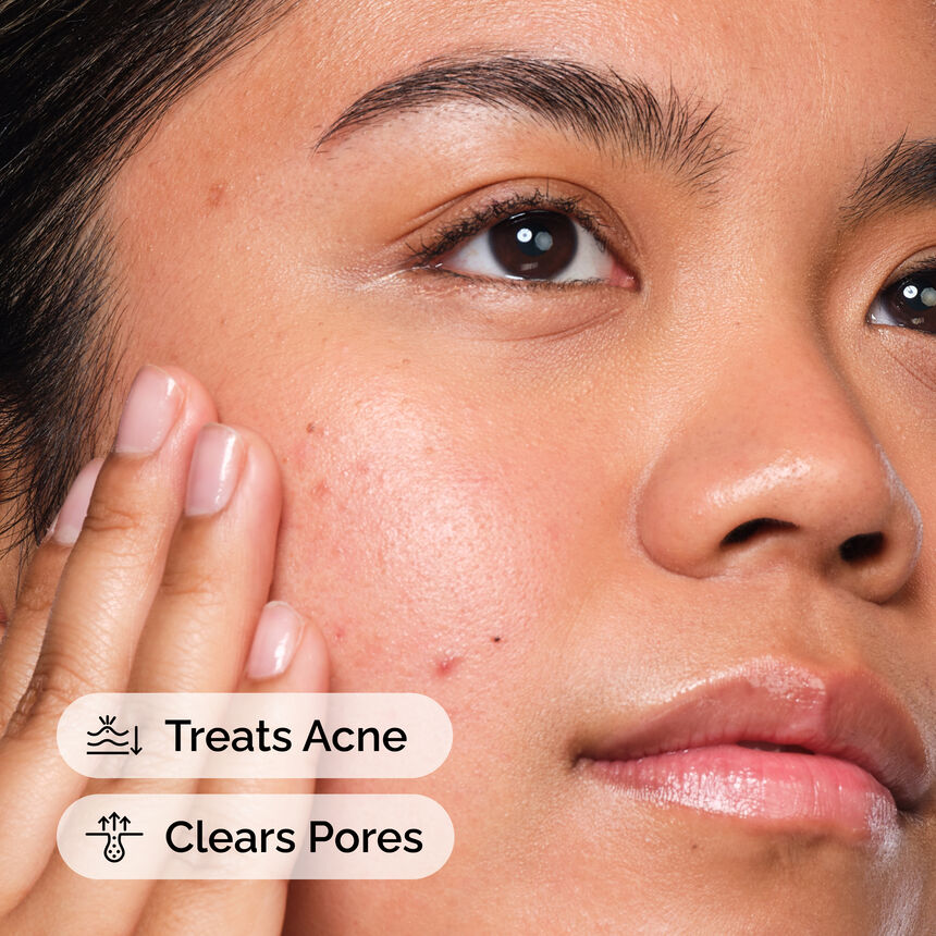 The Ordinary Salicylic Acid 2 Solution thumbnail 2